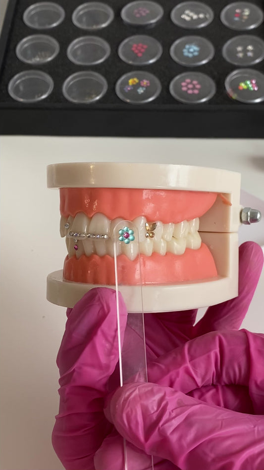 Écarteur dentaire - écarteur de bouche strass dentaire, blanchiment  dentaire – icybabeshop